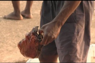 Bénin : Le trafic dÂ’organes humains a le vent en poupe